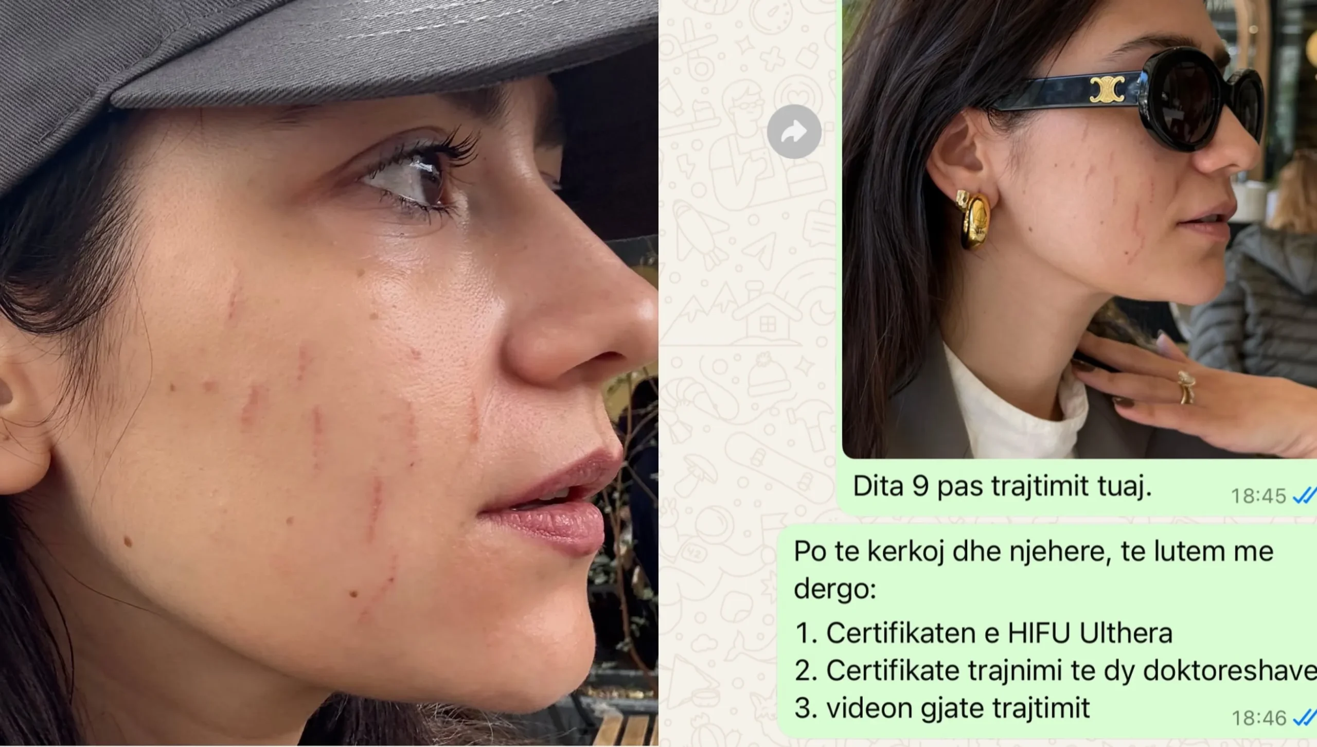 Skandal me klinikën e Xhensila Myrtezajt/ Klientja bën denoncimin, stafi nuk mban përgjegjësi