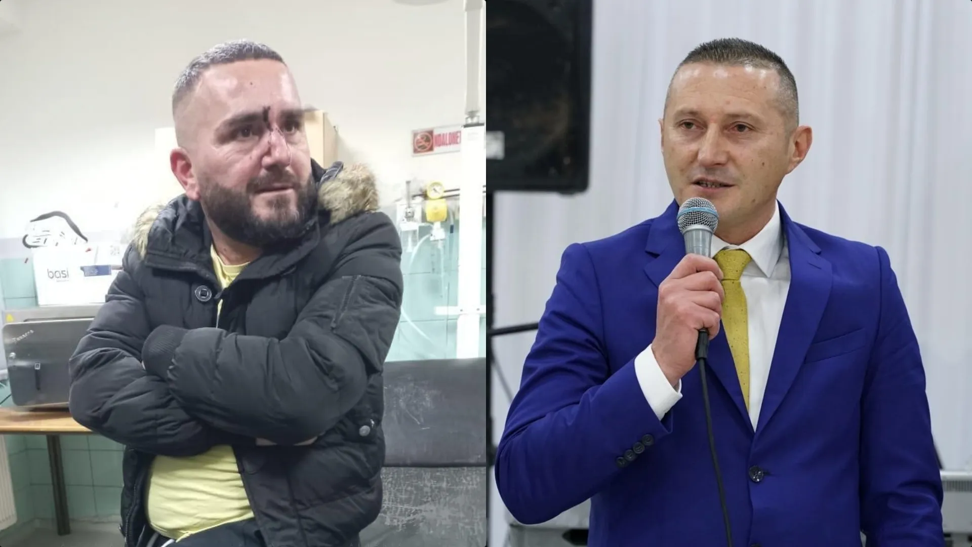 Skandaloze/ Policia reagon për rrahjen në Komisariatin e Rrëshenit: Qytetari goditi murin me kokë