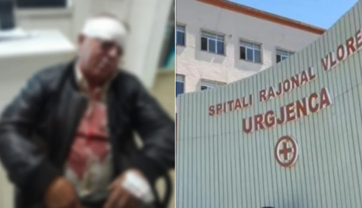 Dy persona dhunojnë barbarisht punonjësin e pastrimit në Vlorë