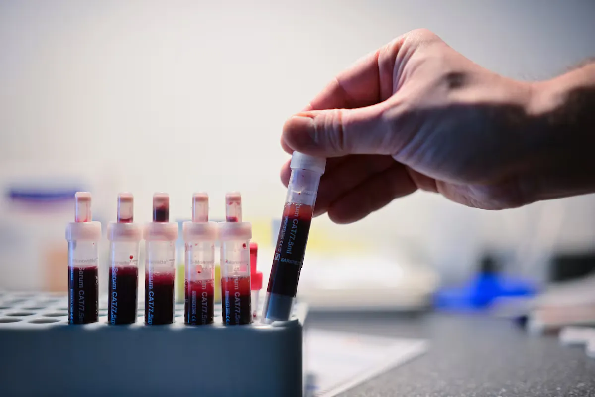Një studim i ri tregon një rrugë premtuese drejt kurës së HIV-it