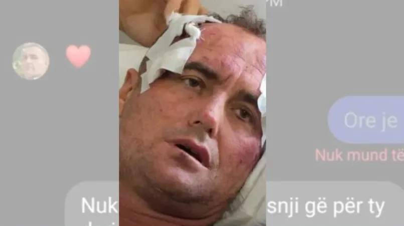 “Të dëshiroj si i çmëndur”/ Flet motra e të dhunuarit: Mesazhet nuk janë të vërteta