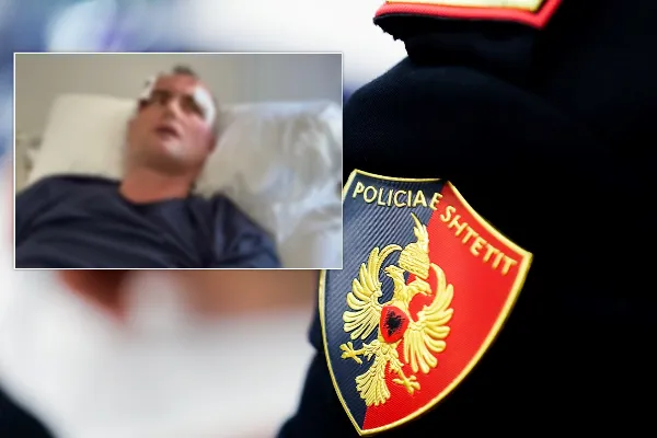 Babë e bir rrihen barbarisht para shtëpisë në Fier, dyshime për përfshirjen e një polici