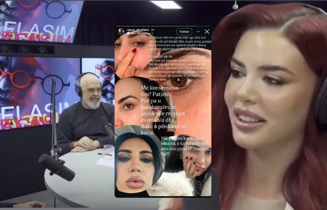 Gazetarja demaskon “mjeken e Ramës”: Më ka lënë shenja të përjetshme (Fotot)