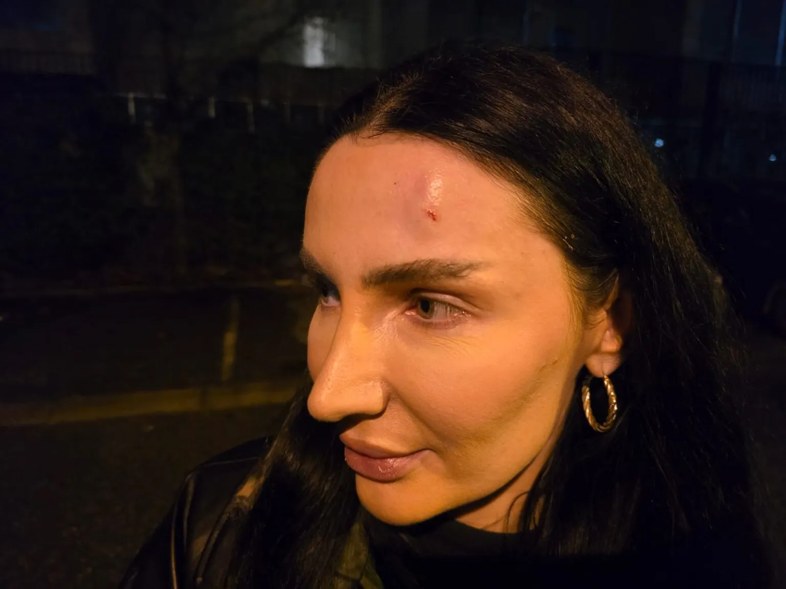 Tensionet në protestë/ Lëndohet ish-kandidatja për deptuete
