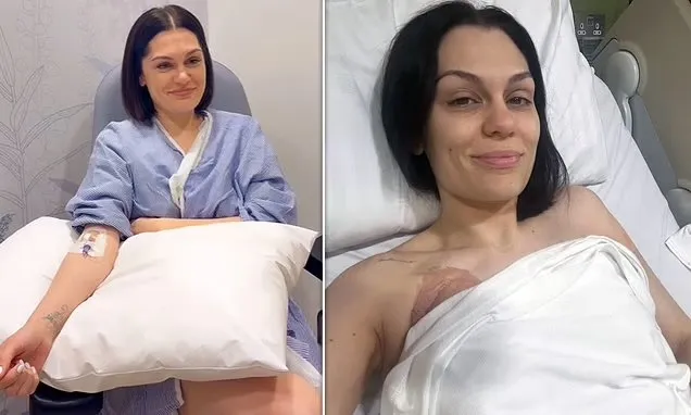 Jessie J fiton betejën me kancerin: Nuk kam më shenja të sëmundjes