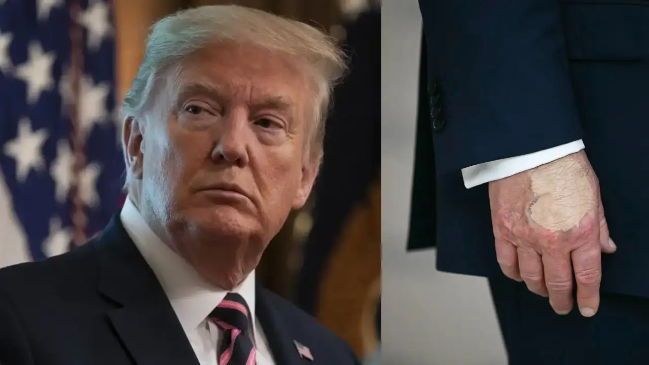 Lodhje, hutim dhe…/ 30 mjekë e cilësojnë Donald Trump të paaftë mendërisht