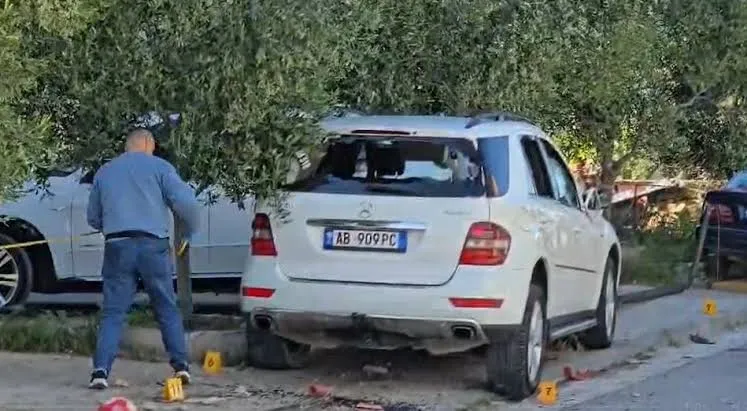 Aksidenti në Durrës, fëmija i plagosur lufton për jetën në Tiranë
