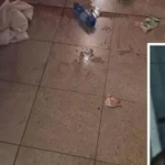 Sulm me thikë në metronë e Milanos, 23-vjeçarja plagoset rëndë në fytyrë