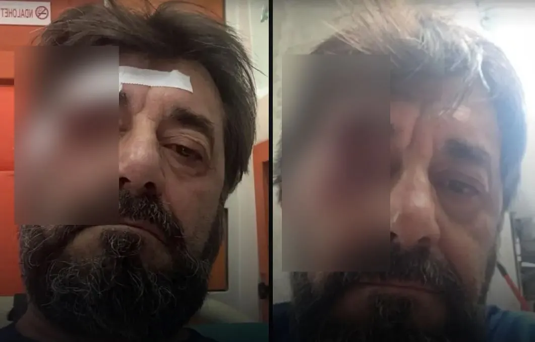 Dhunuan me grushte analistin Ilir Demalia, arrestohet një prej autorëve (Emri)