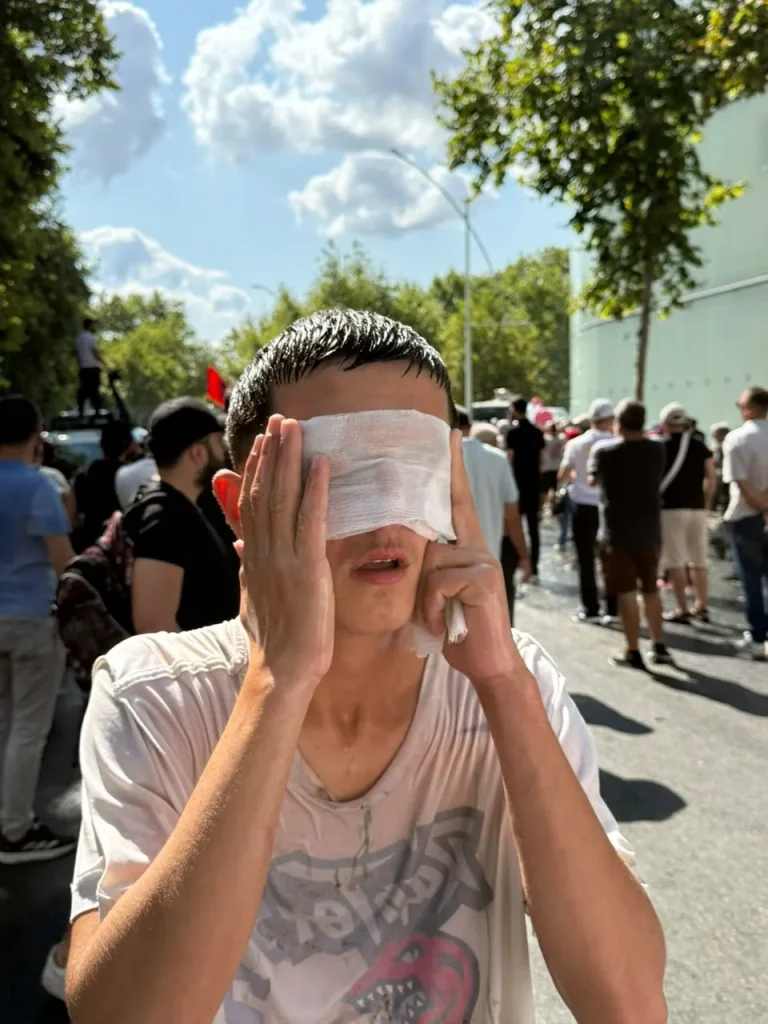 FOTO/ Dy të lënduar gjatë protestës, Policia përdor ujë me ngjyrë blu dhe gaz lotsjellës