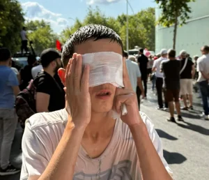 FOTO/ Dy të lënduar gjatë protestës, Policia përdor ujë me ngjyrë blu dhe gaz lotsjellës